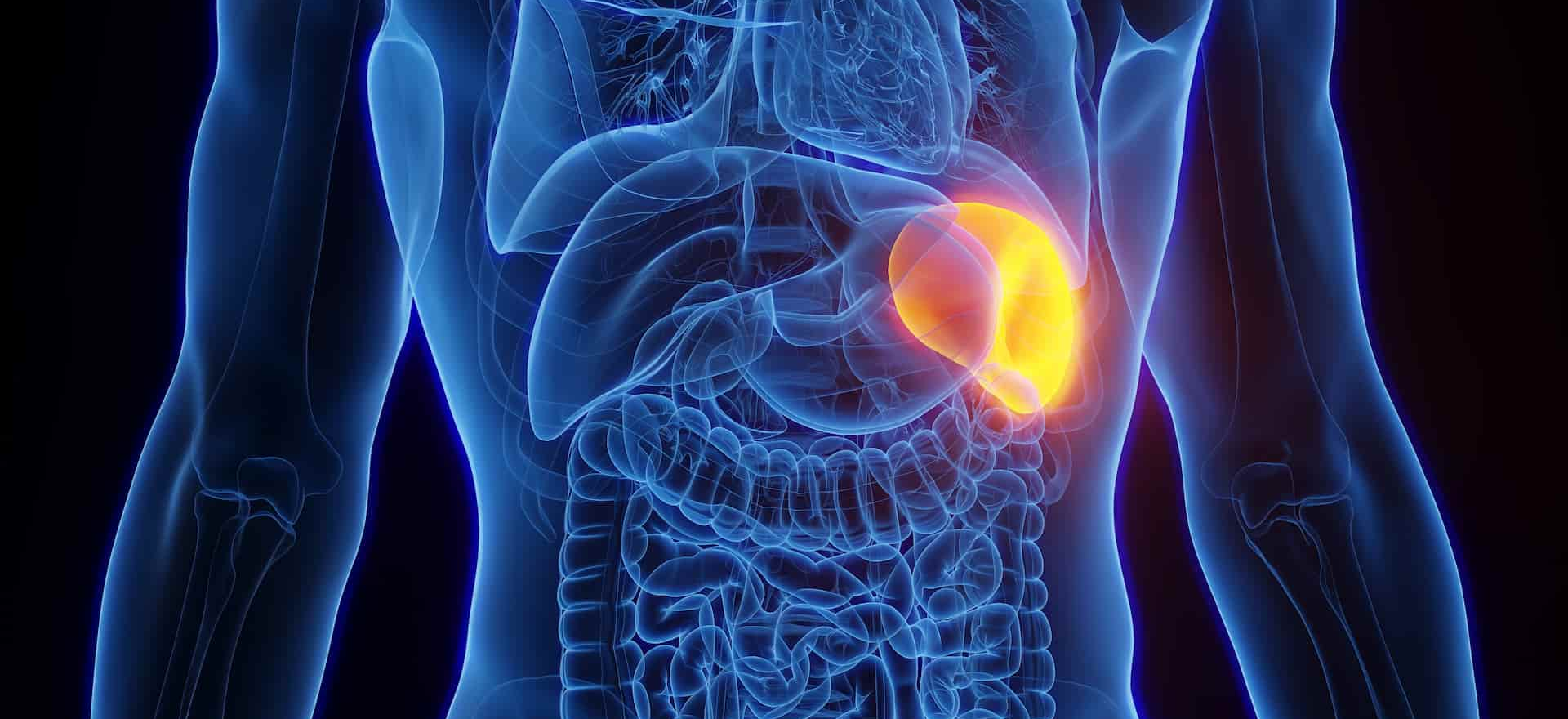 Spleen Surgery