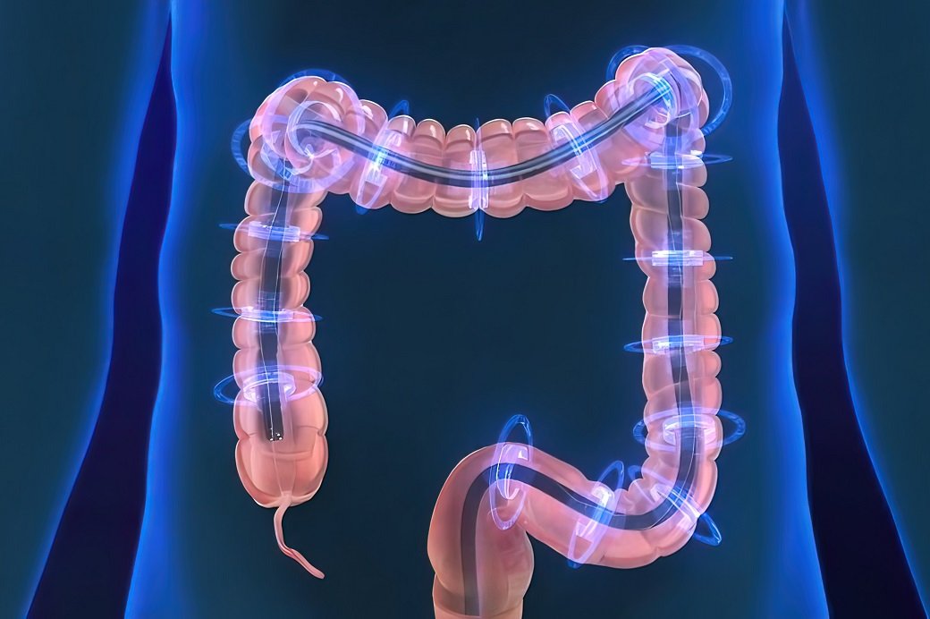 Colonoscopy Procedure
