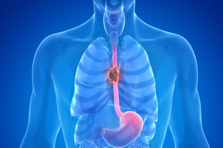 Esophageal Anatomy