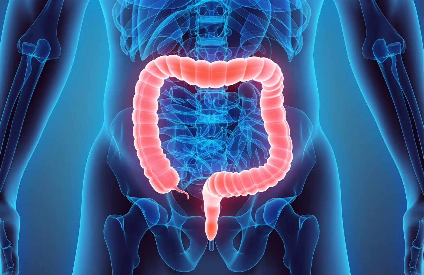 Colorectal Surgery