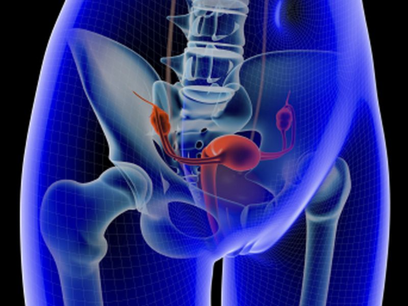 Cytoreductive Surgery