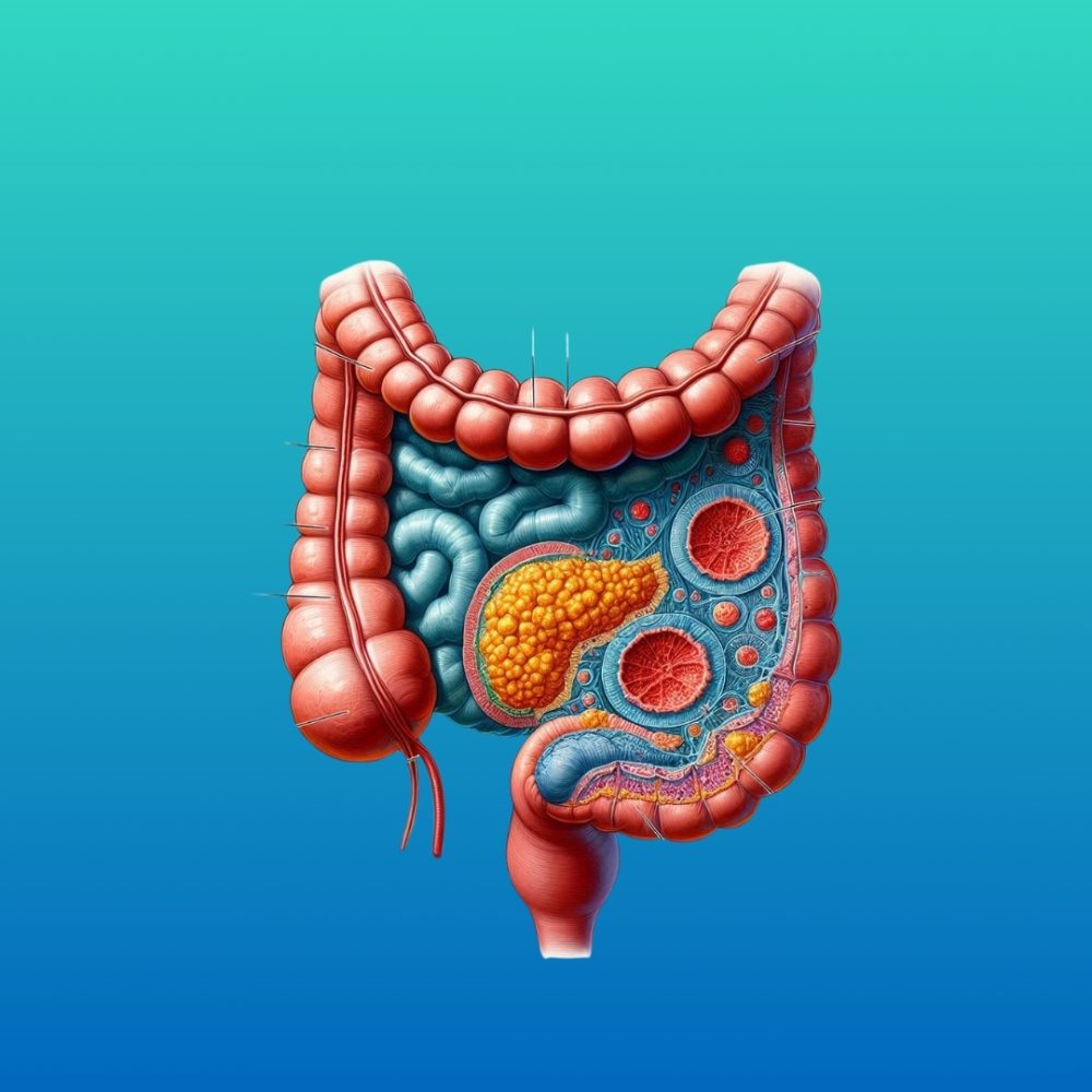Intraperitoneal Chemotherapy