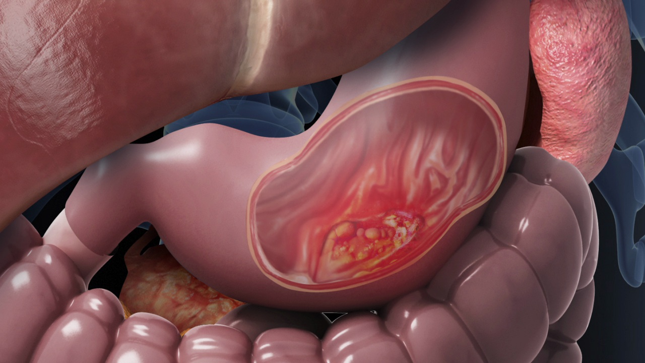 Stomach Anatomy